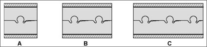 Typical split-connections